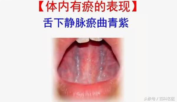 月经期间吃什么好排毒排污血？排尽血块更健康！