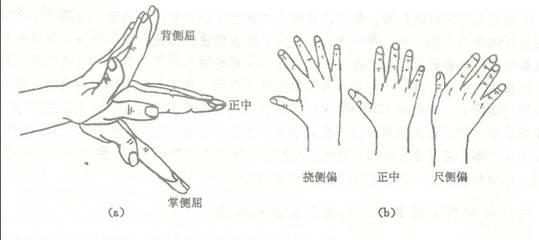 腱鞘炎最佳治疗方法以及日常护理