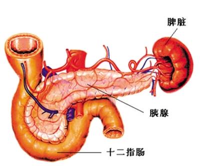 慢性胰腺炎的症状，病因与治疗方法