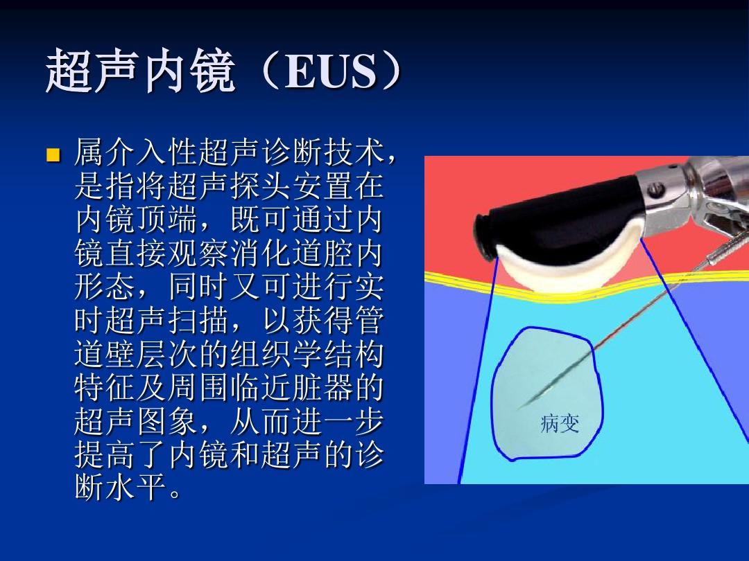 讲课消化内镜概述及常见病内镜下治疗ppt课件