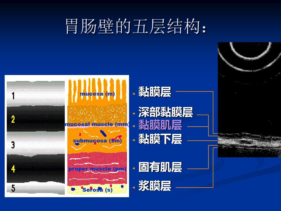 讲课消化内镜概述及常见病内镜下治疗ppt课件