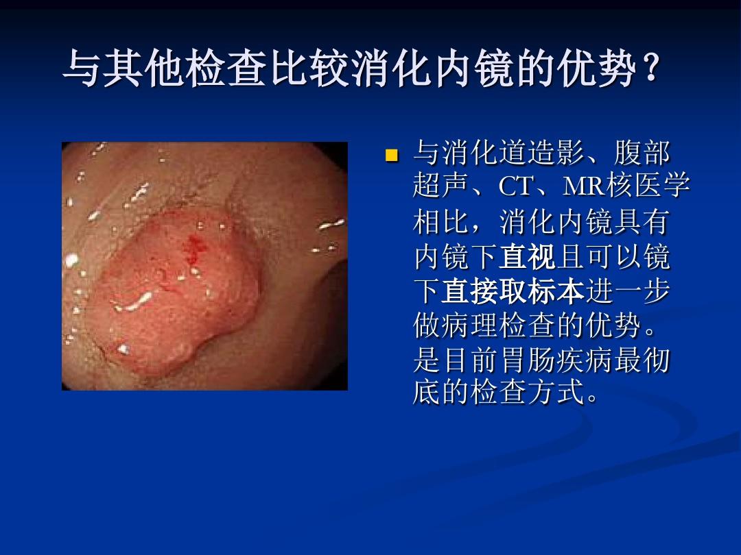 讲课消化内镜概述及常见病内镜下治疗ppt课件